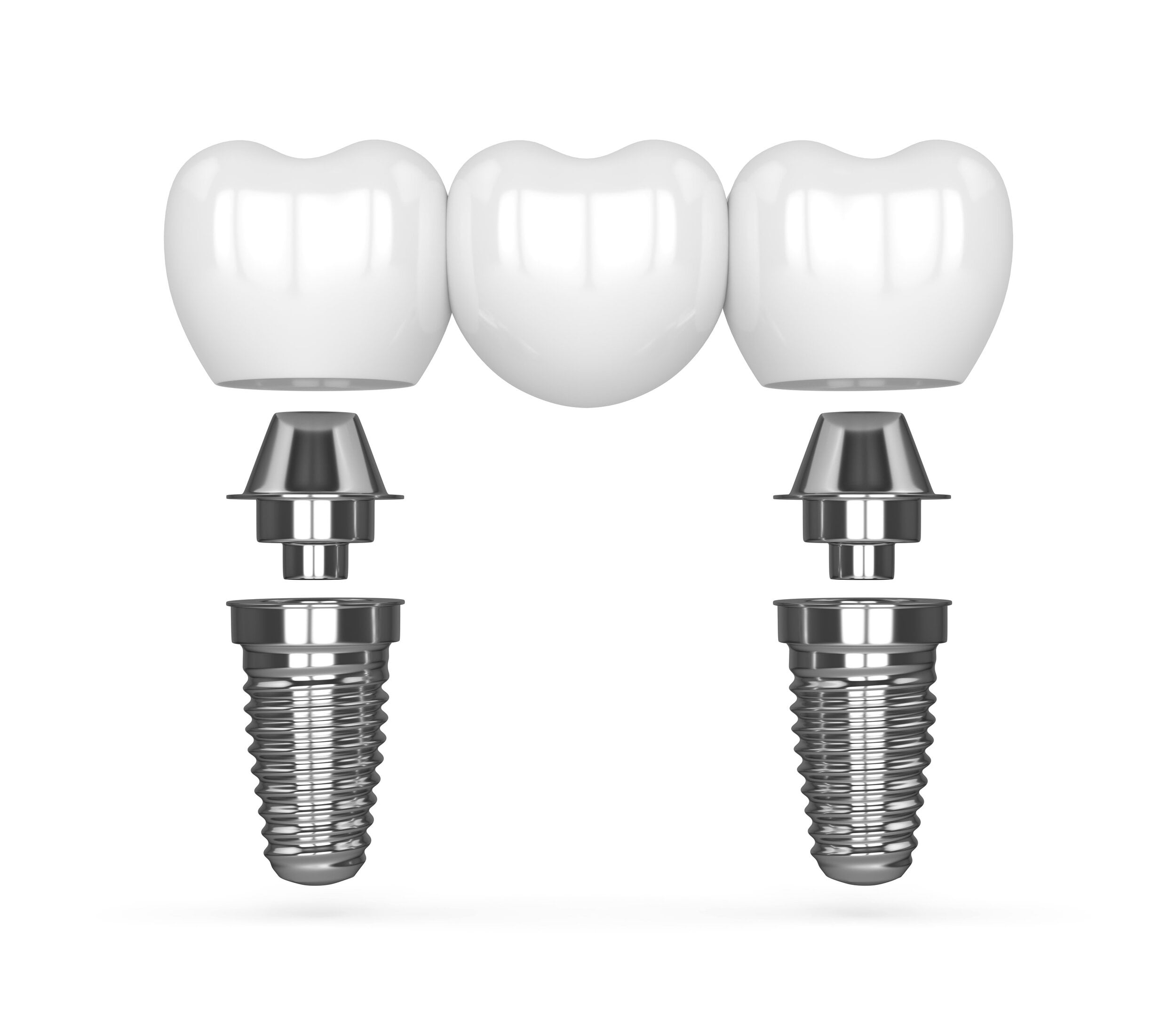 BC1 copy بهترین کلنیک دندانپزشکی مشهد ارائه کلیه خدمات دندانپزشکی با بهترین تجهیزات و اتاق عمل بیهوشی