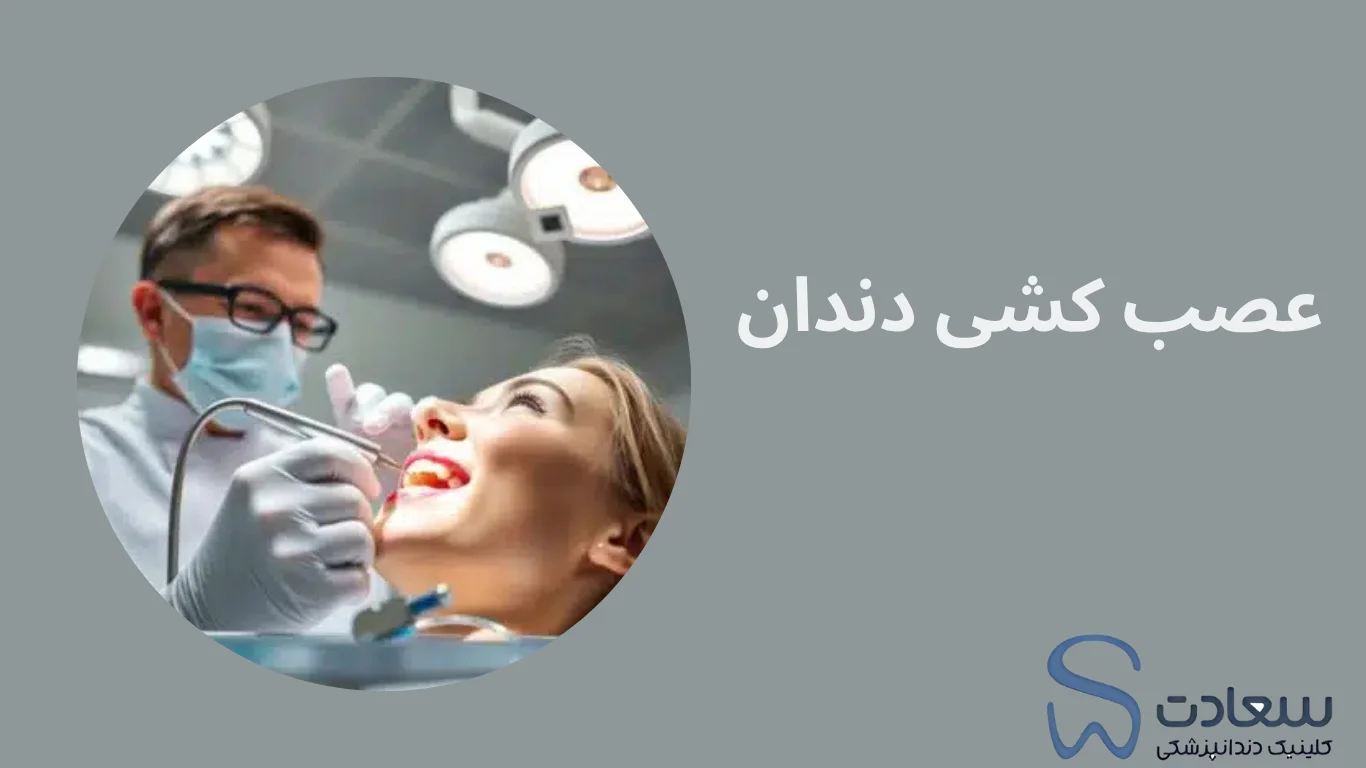 عصب کشی مشهد