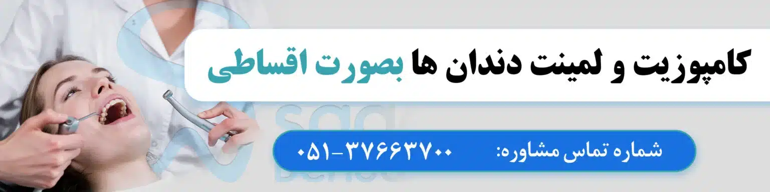 قیمت کامپوزیت دندان در مشهد