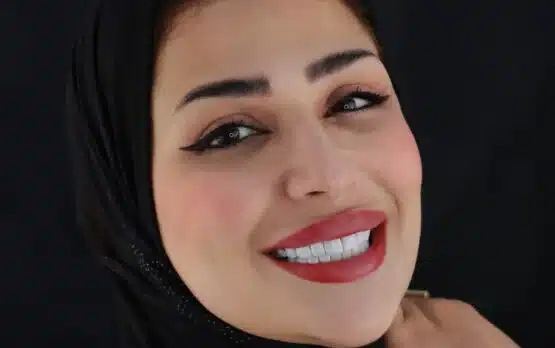 دندانپزشکی زیبایی