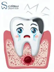 آیا جرم گیری باعث حساسیت دندان میشود؟