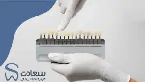 چرا روکش دندان یکی از پرتقاضاترین درمان‌های دندانپزشکی در مشهد است