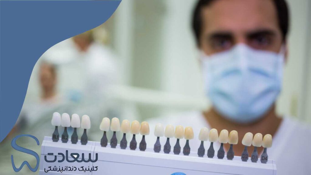 تفاوت لمینت دندان با سایر روش‌های زیبایی مانند کامپوزیت و روکش