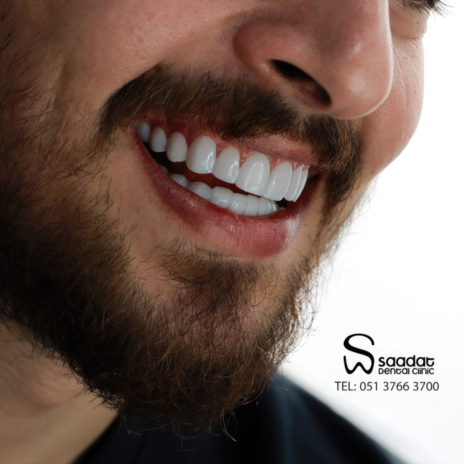 ترجیح روش کمتهاجم نسبت به لمینت