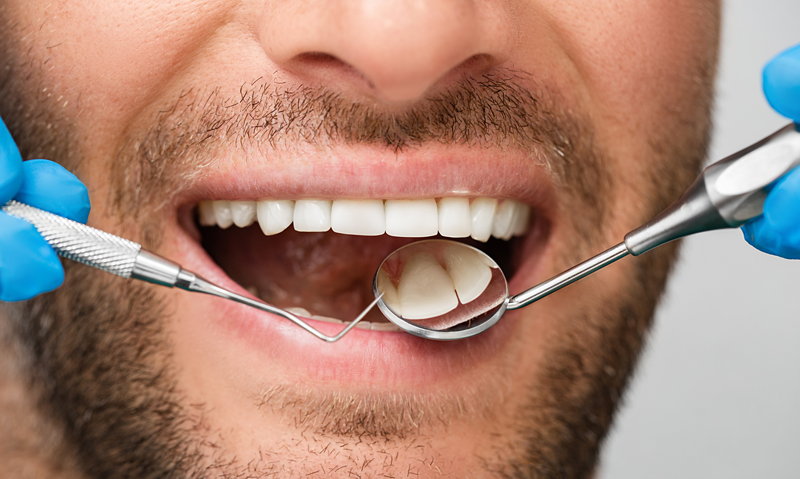 بلیچینگ حرفه‌ای: سفیدی درخشان و ایمن