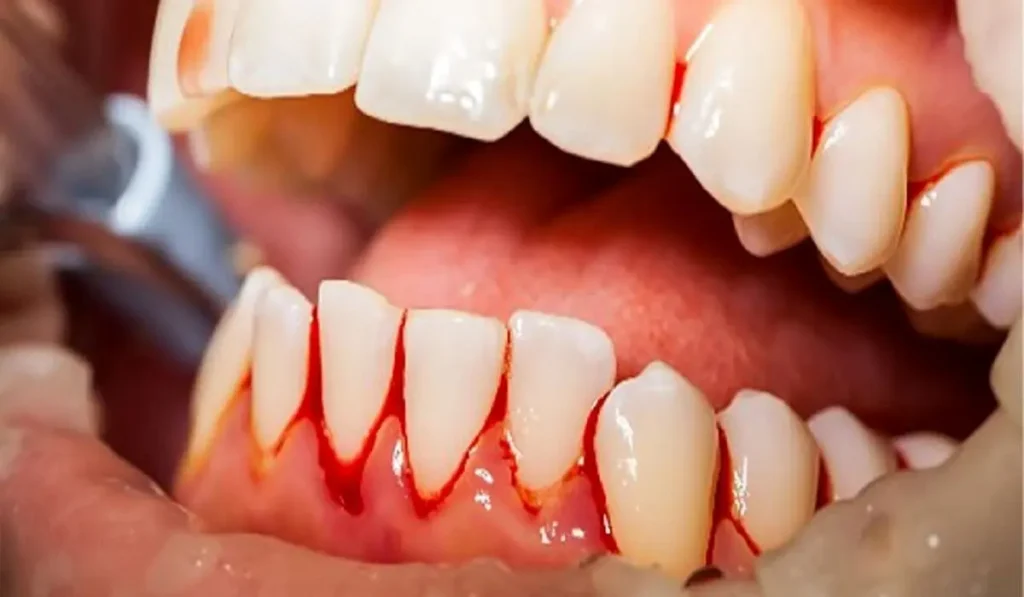 آینده تحقیقات: جهت‌گیری‌های جدید در مطالعه استرس و سلامت دهان