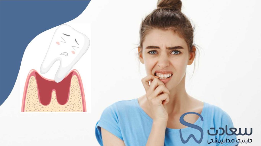 لق شدن دندان | علل، درمان و روش‌های پیشگیری سریع1404 - Saadat Dental Clinic