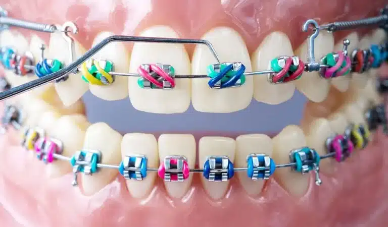 ارتودنسی دندان در بهترین کلینیک دندانپزشکی مشهد-1404