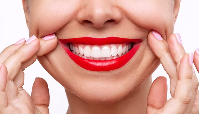هنر زیباییشناسی در ساخت لبخند سلبریتی ها