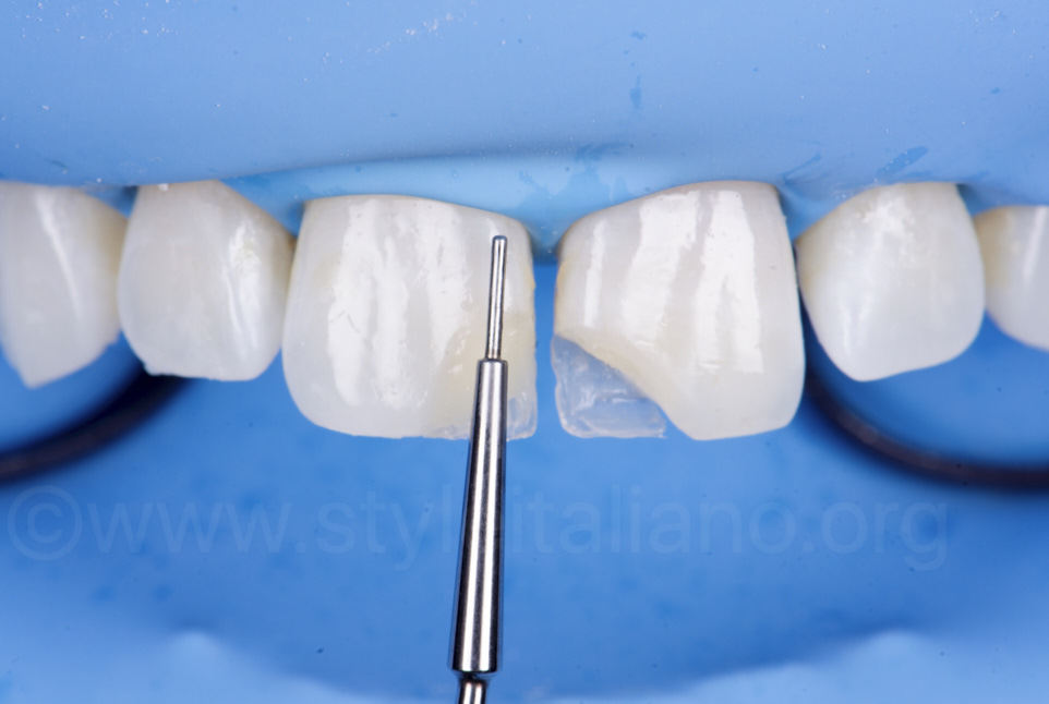 سدیشن دندانپزشکی چیست و سطوح مختلف آن کدامند؟